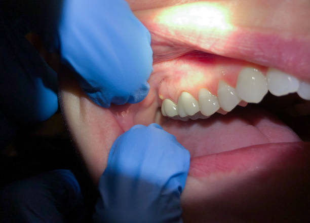 Best Urgent Tooth Repair  in Bartlett, TN